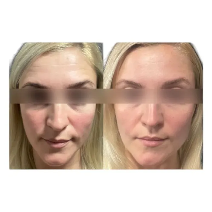 Крем ультра разглаживающий корректор морщин Alphascience Surface [CR]